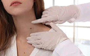 Skin Cancer