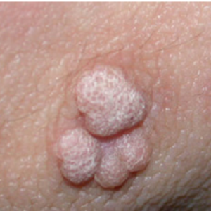 anal