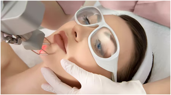 laser treatment