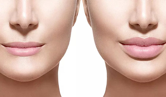 PDO Thread Lift Results