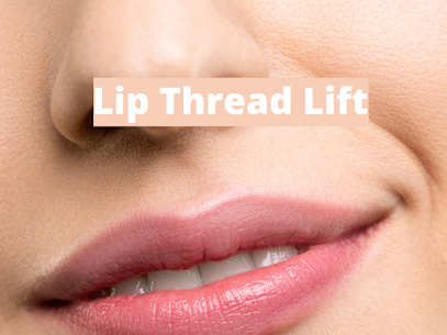 Lip Thread Lift